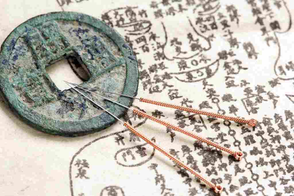 l’acupuncture existait déjà à la préhistoire